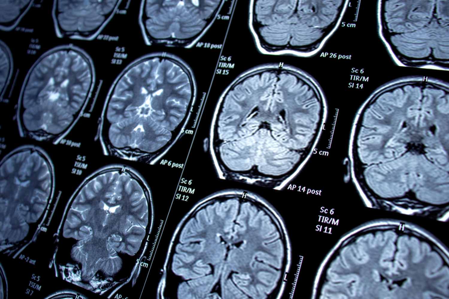 Neurologia_3